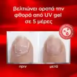 ESSIE TO THE RESCUE ΘΕΡΑΠΕΙΑ ΓΙΑ ΦΘΑΡΜΕΝΑ ΝΥΧΙΑ ΑΠΟ UV GEL - Image 5